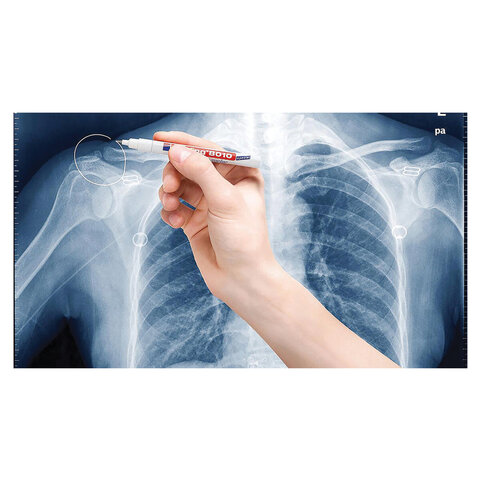 Маркер для рентгеновских пленок EDDING "8010", БЕЛЫЙ, 0,8 мм, круглый наконечник, на лаковой основе, E-8010/49